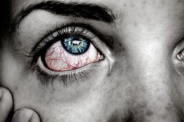 QUE ES LA CONJUNTIVITIS