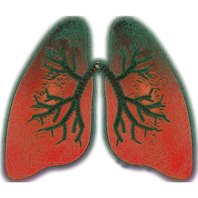 Embolia Pulmonar, Causas, Diagnóstico y Tratamientos